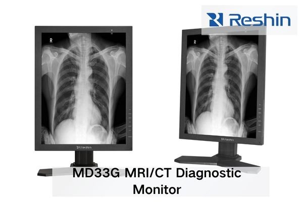MD33G high-grayscale medical display presenting a detailed MRI scan with clear soft-tissue boundaries
