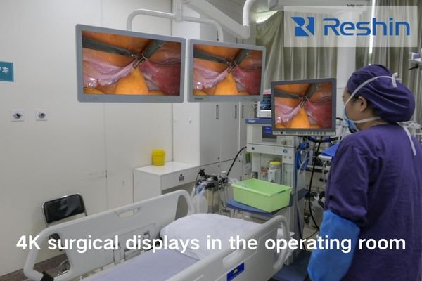 Modern operating room with multiple surgical displays showing endoscopic imagery and patient data