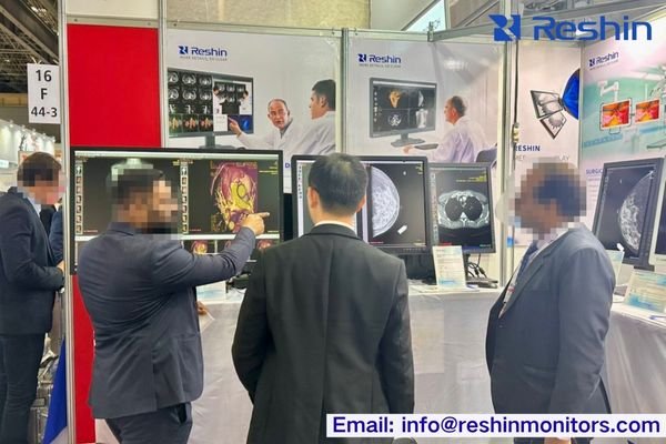 Medical professional examining diagnostic images on high-resolution medical-grade displays in a hospital radiology department.