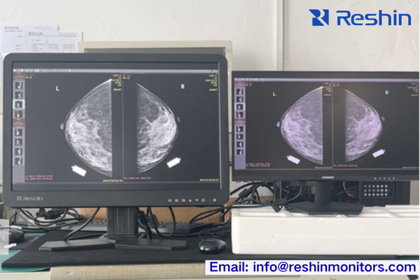 Comparison of consumer-grade versus medical-grade display performance showing DICOM calibration differences and specification variances.