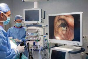 Monitor quirúrgico Mini-LED 4K UHD MS323PA mostrando imágenes de endoscopia gastrointestinal en una sala de endoscopia