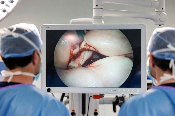 MS323PA 4K UHD Mini-LED Surgical Monitor used for laparoscopic surgery visualization in a modern operating room