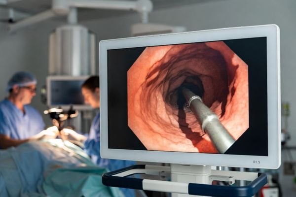 MS324PA 31.5 inch 3D 4K UHD Surgical Monitor displaying 3D endoscopic imaging in an endoscopy suite