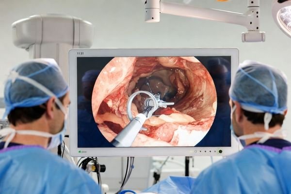 MS324PA 31.5 inch 3D 4K UHD Surgical Monitor used for 3D laparoscopic surgery visualization in a modern operating room