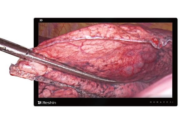 MS324PA 31.5 inch 3D 4K UHD Surgical Monitor