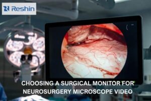 Neurosurgery OR scene with a surgical microscope and an articulated surgical monitor displaying a non-graphic microscope-view image with fine microvascular detail.