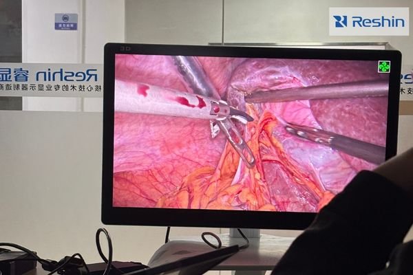 Reshin annual gala 2026 Shenzhen manufacturing first surgical display priorities