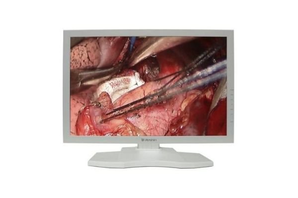 Medical display monitor MS247SA for surgical endoscopy visualization, showing real-time tissue and vessel detail during surgery.