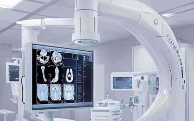 Mobile C-arm imaging system with display showing fluoroscopy X-ray images in a clinical room