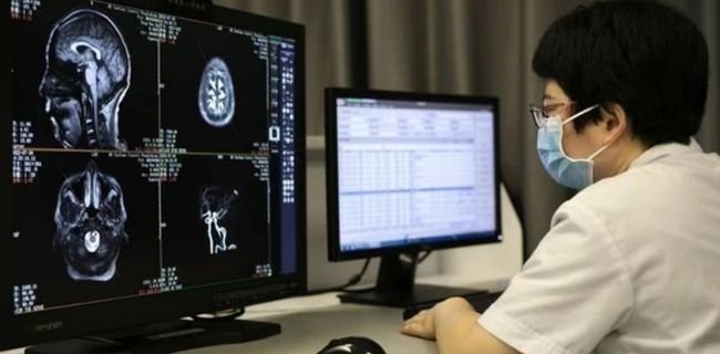 Radiologist reviewing MRI brain images on a professional PACS monitor at a medical imaging workstation