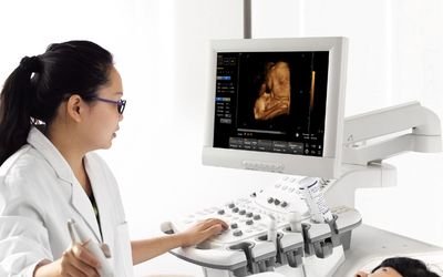 Ultrasound examination with clinician using ultrasound system and monitor showing fetal imaging