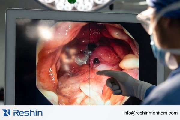A surgical monitor displaying tissue detail with controlled glare under bright OR lighting