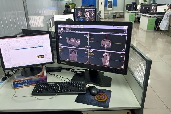 Reshin diagnostic monitor displaying CT images in a PACS workstation environment