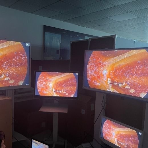 Multiple surgical displays reproducing the same endoscopic image during connected-system verification