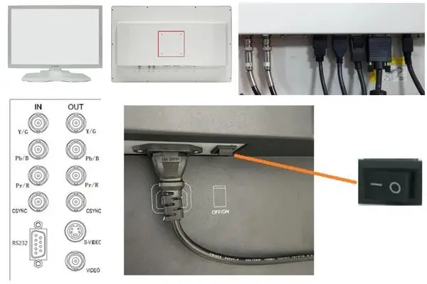 Surgical display installation guidance showing VESA mounting, video interfaces and power connection