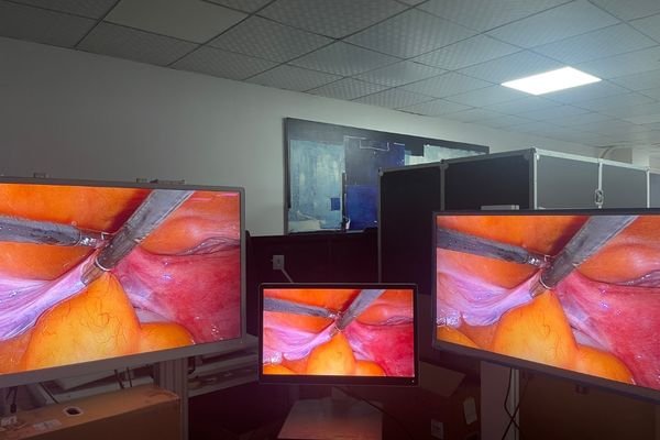 Multiple medical displays showing the same surgical visualization during multi-screen image reproduction testing